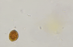 Haematococcus
