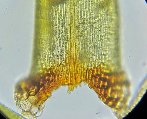 Image of Blindia acuta by (c) Helen Waterman, some rights reserved (CC BY)