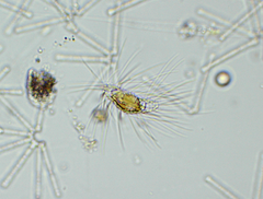 Mallomonas caudata
