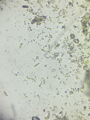 Chaenotheca xyloxena