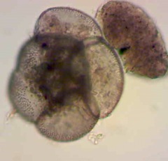 Foraminifera