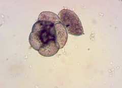 Foraminifera