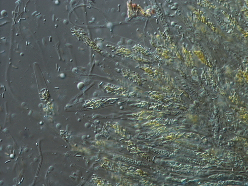 Diatrypella betulina
