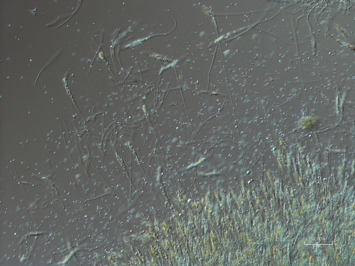 Diatrypella betulina