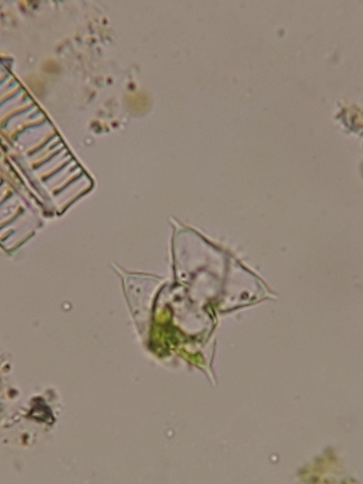 Staurodesmus mucronatus