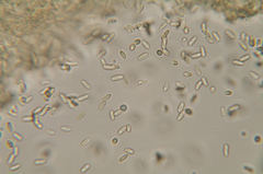 Rhizopogon subsalmonius