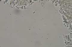 Macrotyphula phacorrhiza