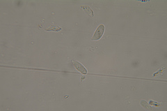 Macrotyphula phacorrhiza