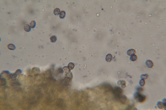 Melanoleuca microspora