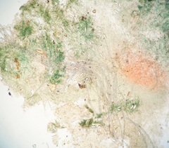 Microstoma protractum
