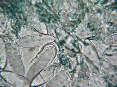 Microstoma protractum