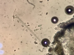 Arthonia punctiformis