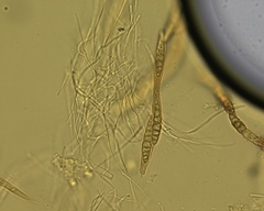 Lophiostoma
