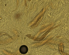 Lophiostoma
