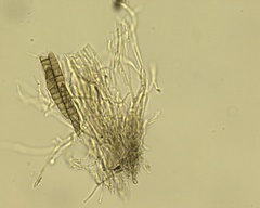 Lophiostoma