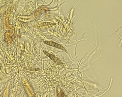 Lophiostoma
