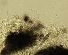 Lophiostoma