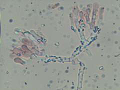 Athelia epiphylla
