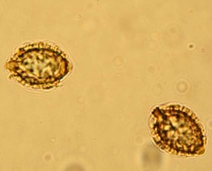 Descomyces