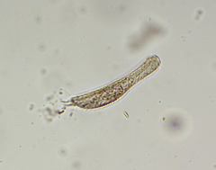 Gastrotricha