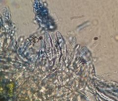 Bryocentria hypothallina