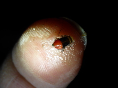 Aphrophora permutata