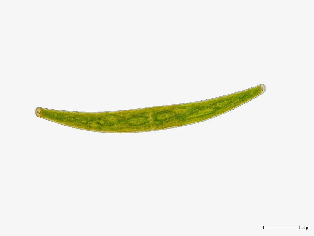 Closterium striolatum