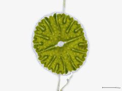 Micrasterias denticulata