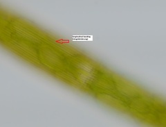 Closterium striolatum