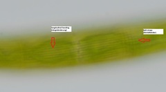 Closterium striolatum