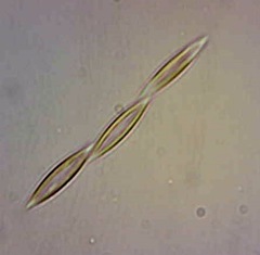 Pseudo-nitzschia