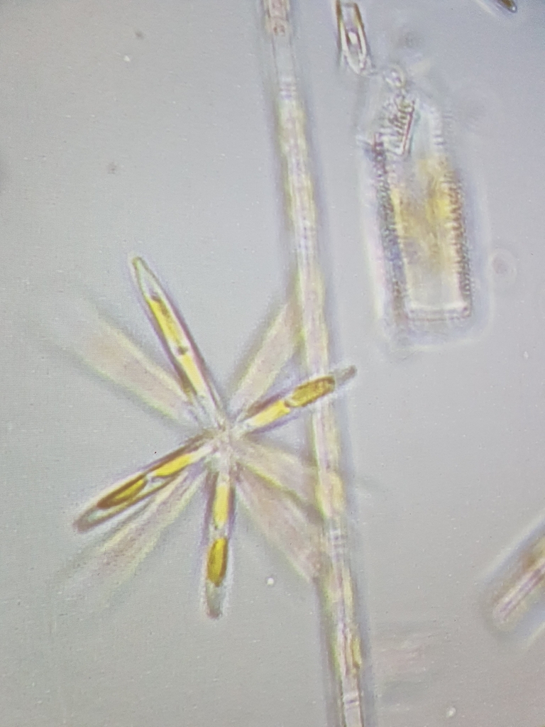 Nitzschia fruticosa