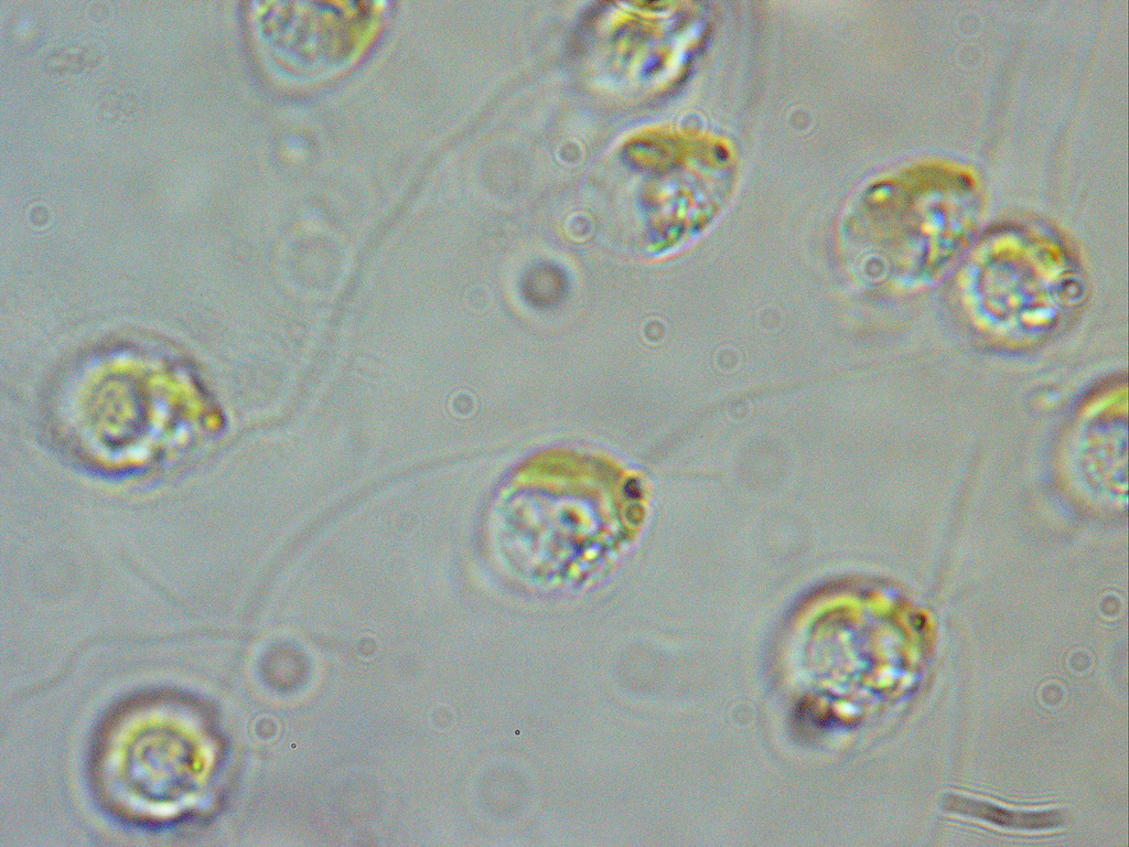 Uroglena