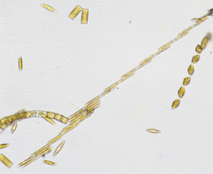 Bacillaria paxillifera