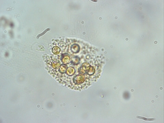 Chrysostephanosphaera