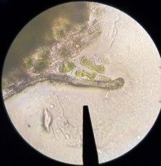 Cylindrocystis