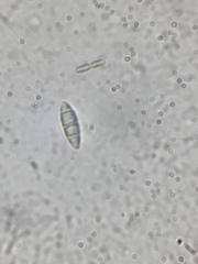 Bilimbia sabuletorum