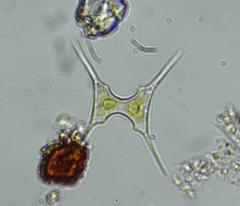 Staurodesmus extensus