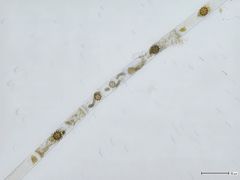 Micromyces zygogonii