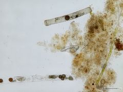 Micromyces zygogonii