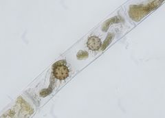 Micromyces zygogonii
