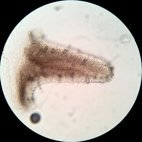 Resupinatus (Photo 7 of 9)