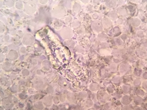 Resupinatus (Photo 8 of 9)