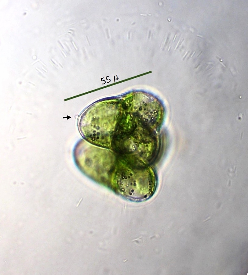 Staurastrum brevispina