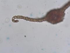 Imbribryum alpinum
