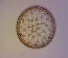 Actinocyclus
