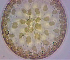 Actinocyclus