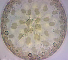 Actinocyclus