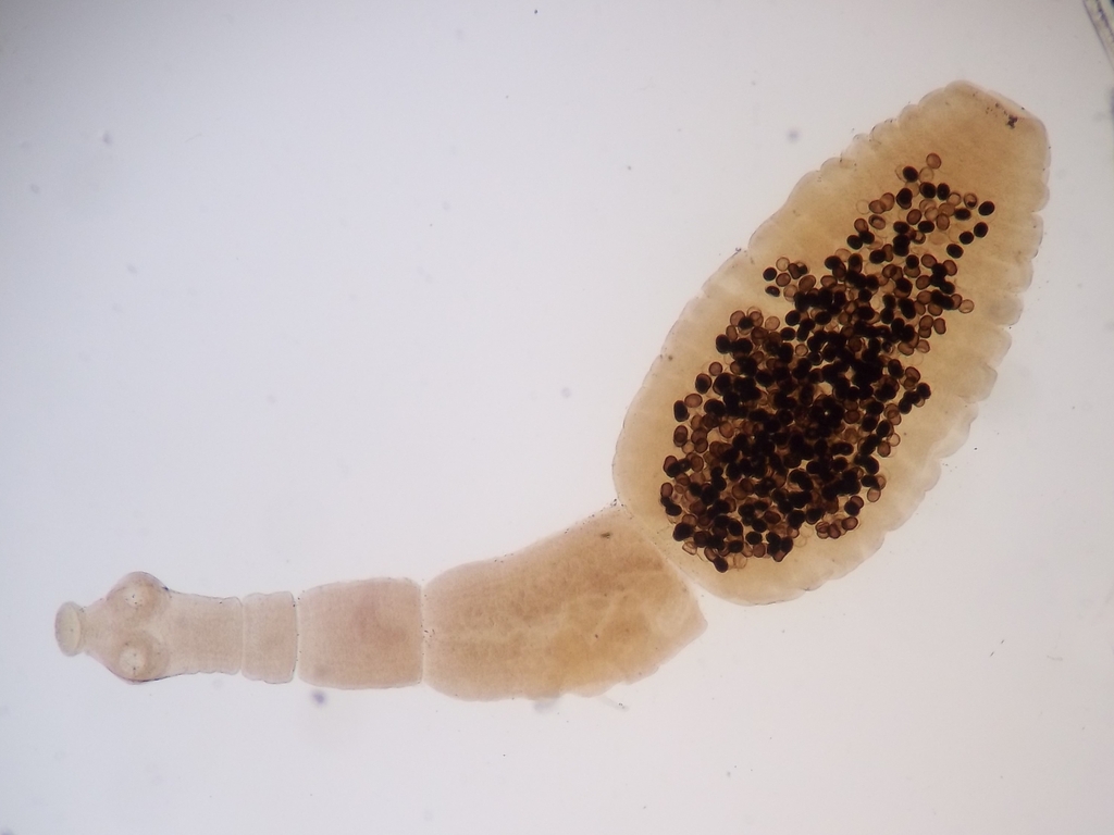 Hydatid Worm