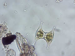 Staurastrum anatinum